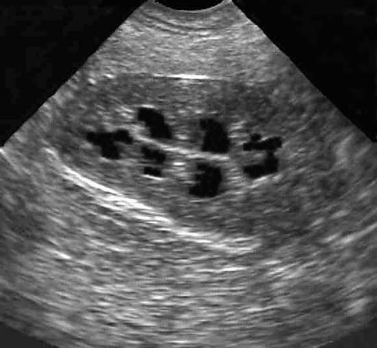 53 Best Images Cat Ultrasound Cost Uk : Why You Must Experience Abyssinian Kittens For Sale Cost ...